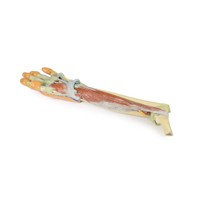 3D Printed Forearm and Hand with Deep Dissection